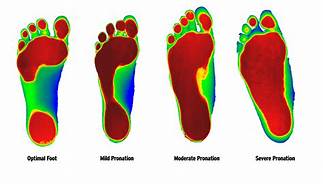 foot types 2